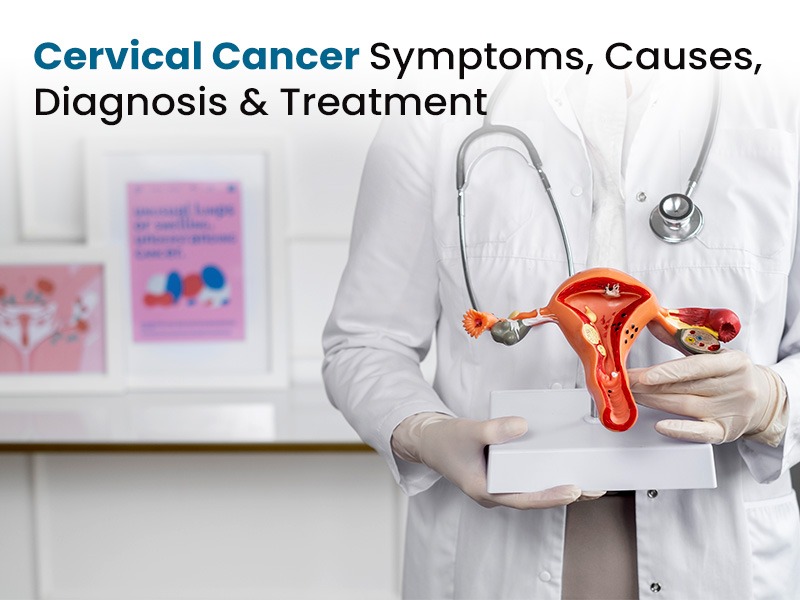 Cervical Cancer Symptoms, Causes, Diagnosis & Treatment